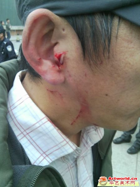 798物业安保人员杨某近日耳部病情加重，左耳出现失聪，